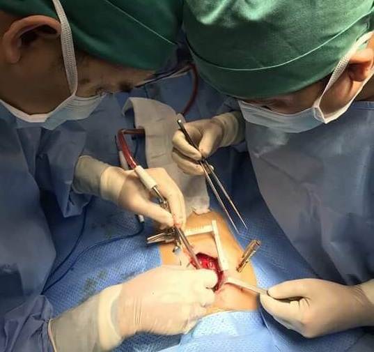 Các bác sĩ của Bệnh viện Nhi Đồng Thành Phố thực hiện phẫu thuật lấy cây bút bi khỏi ngực bé T.