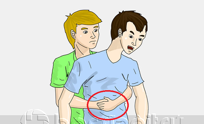   Hình ảnh minh họa cho biện pháp đẩy bụng sơ cứu cho nạn nhân hóc dị vật  