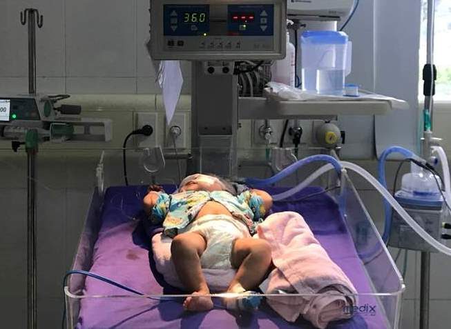 Bé gái 9 tháng tuổi bị viêm cơ tim cấp dẫn đến nguy kịch được các bác sĩ cứu sống thành công