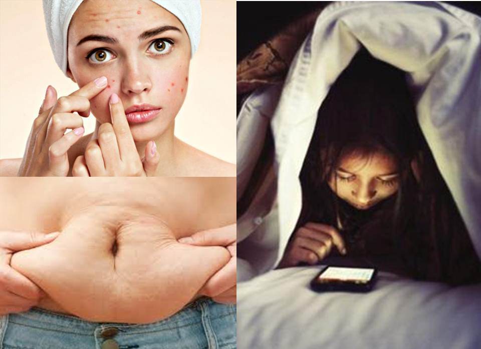 Thường xuyên ngủ muộn sau 23 giờ sẽ gây hại cho da, cơ thể tích tụ mỡ dẫn đến thừa cân, béo phì