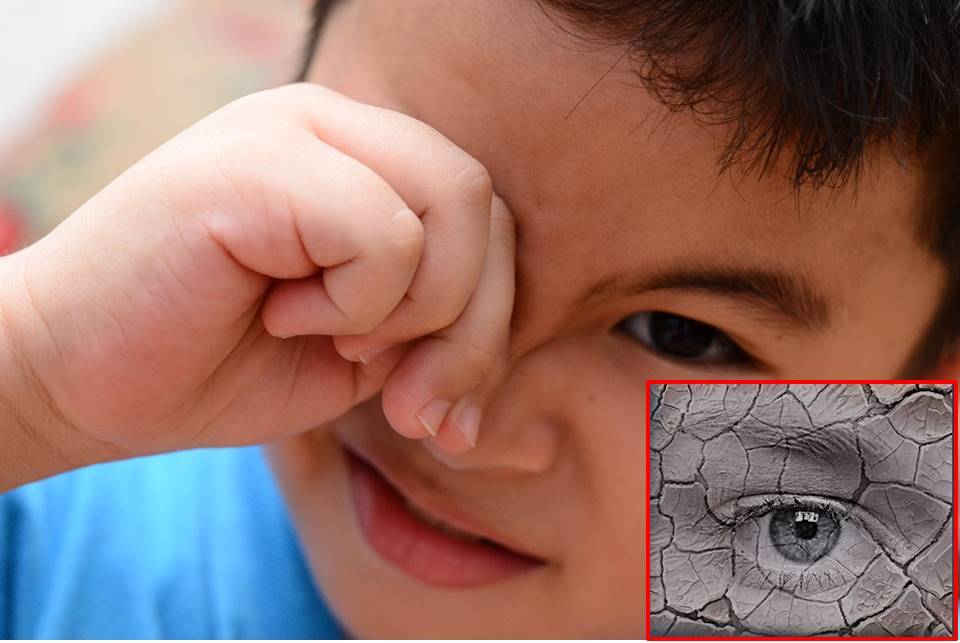 Trẻ nhỏ thường xuyên dụi mắt, chảy nước mắt là dấu hiệu cảnh báo trẻ có vấn đề về thị lực. Ảnh minh họa