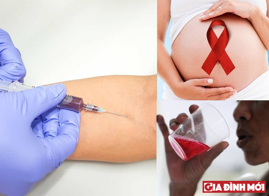 HIV Thường lây truyền qua đường máu, quan hệ tình dục không an toàn và truyền từ mẹ sang con. Ảnh minh họa