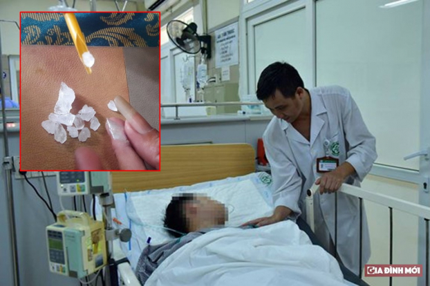   Bệnh nhân bị ngộ độc ma túy đang được điều trị tại Bệnh viện Bạch Mai. Ảnh minh họa  