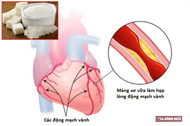   Người bị bệnh động mạch vành ăn nhiều đường sẽ tạo gánh nặng cho tim, làm bệnh tăng nặng. Ảnh minh họa  