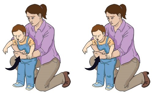   Khi trẻ bị dị vật đường thở, người lớn có thể áp dụng biện pháp sơ cứu cho trẻ bằng cách tiến hành 5 lần đẩy bụng. Ảnh minh họa  