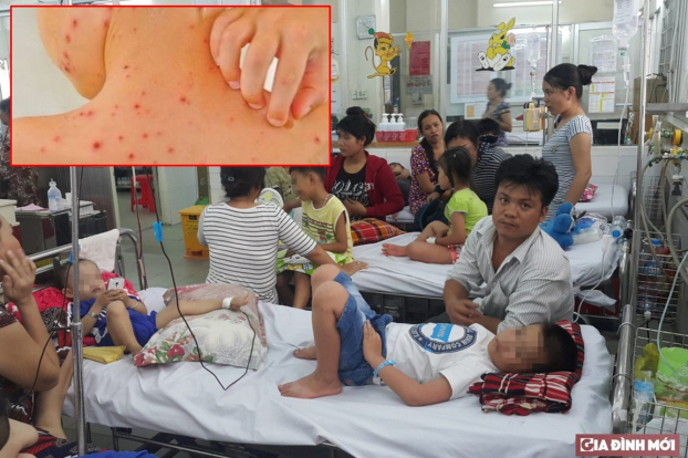   Hiện tất cả các quận, huyện ở Hà Nội đã ghi nhận bệnh nhân mắc sốt xuất huyết và sởi. Ảnh minh họa  