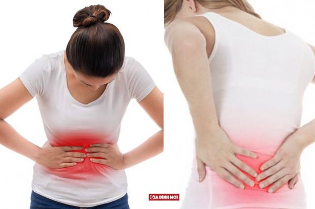   Thường xuyên bị đau bụng và đau lưng đều là những biểu hiện sớm của bệnh ung thư buồng trứng. Ảnh minh họa  