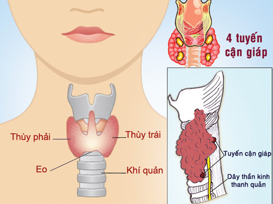   Phẫu thuật tuyến giáp dễ gây ảnh hưởng đến chức năng nói và thở của người bệnh. Ảnh minh họa  