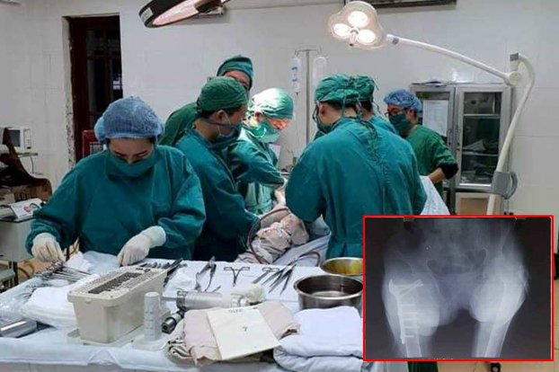   Các bác sĩ tiến hành phẫu thuật điều trị cho cụ bà 103 tuổi bị ngã gãy xương đùi  