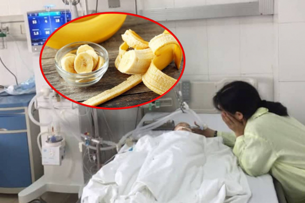   Bé trai 8 tháng tuổi bị hóc chuối tiêu phải vào viện cấp cứu  