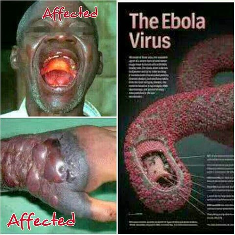 ebola_giadinhmoi