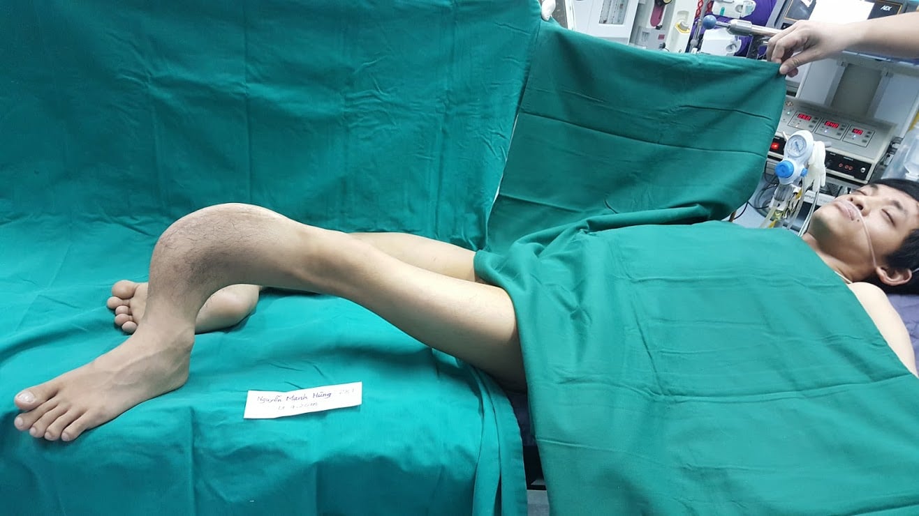    Đôi chân của bệnh nhân trước khi được phẫu thuật  