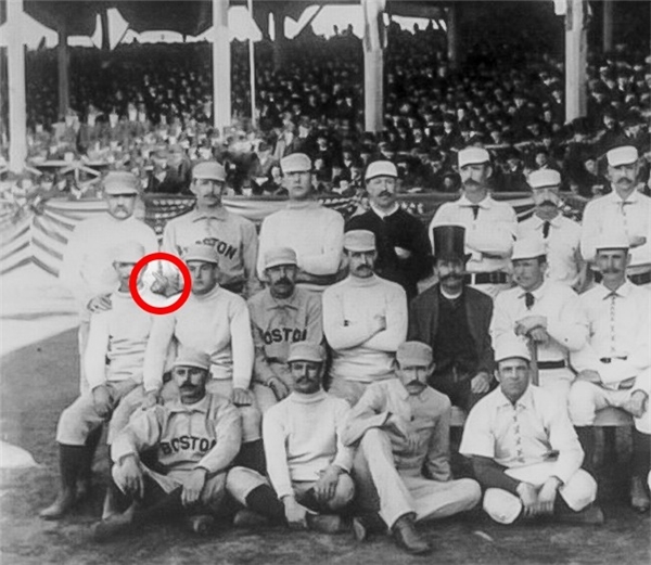 Năm 1886, cầu thủ bóng đá Charles Radbourn khiến dư luận dậy sóng khi bức ảnh của anh lan truyền rộng rãi. Trong ảnh, Charles đưa 