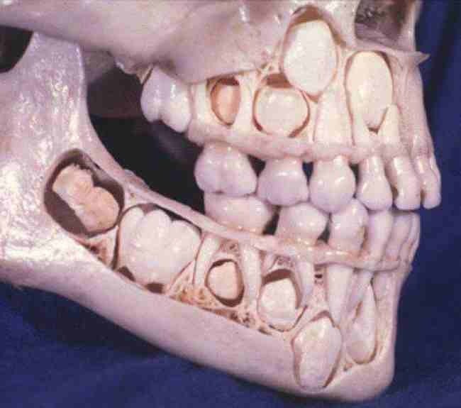 Bạn sẽ rất khó quan sát cấu trúc răng của mình. Ảnh trên là mô hình xương của một đứa trẻ đã mọc hoàn chỉnh răng sữa. Răng vĩnh viễn vẫn đang nằm ở dưới, chờ thời cơ 