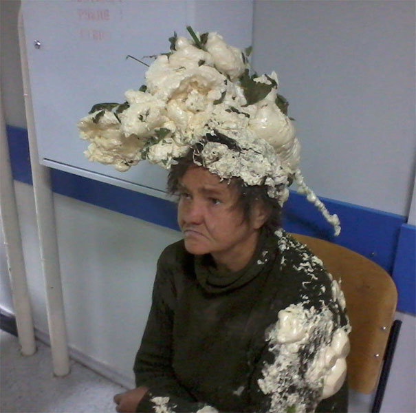  Người phụ nữ này đã dùng một số chất liệu kỳ lạ để thử lên mái tóc của mình. Sau đó, bà ấy phải đi thẳng tới bệnh viện  