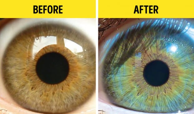 5 điều kỳ lạ làm thay đổi màu mắt của bạn