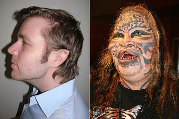   Dennis Avner trước và sau khi phẫu thuật thành người mèo  