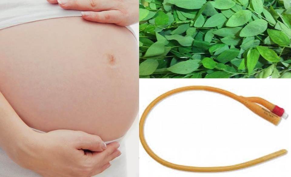 Bộ Y tế đề nghị xác minh thông tin thai phụ ở tử vong do phá thai bằng ống thông tiểu và nước rau ngót theo cách của thầy lang