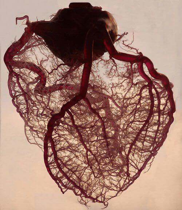 Một quả tim người đã bỏ hết mỡ và cơ, chỉ còn động mạch vành và tĩnh mạch