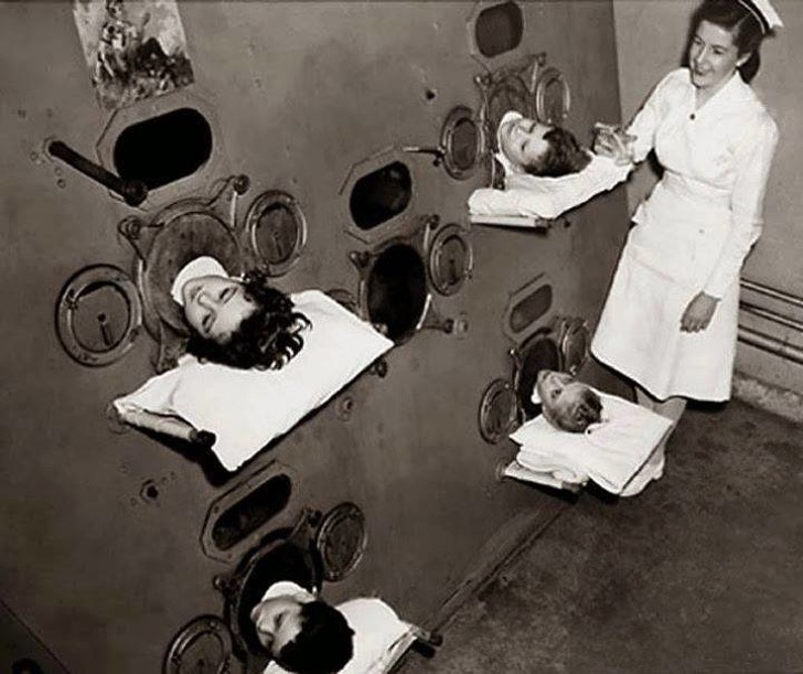 Những đứa trẻ nằm trong phổi sắt trước khi vắc-xin bại liệt ra đời, 1937
