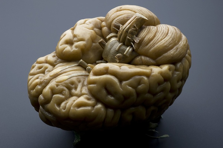 Vào những năm 1850, con người tưởng tượng bộ não trông như thế này
