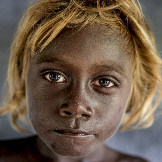   Người dân ở quần đảo Solomom (Melanesia) có màu da đen và tóc vàng tự nhiên do gene  