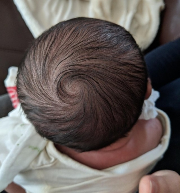   Xoáy tóc trên đầu bé trai sơ sinh  