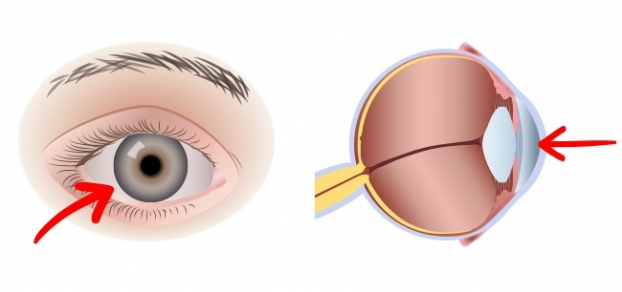 Điều gì sẽ xảy ra với cơ thể nếu bạn ăn 2 quả trứng mỗi ngày? 2