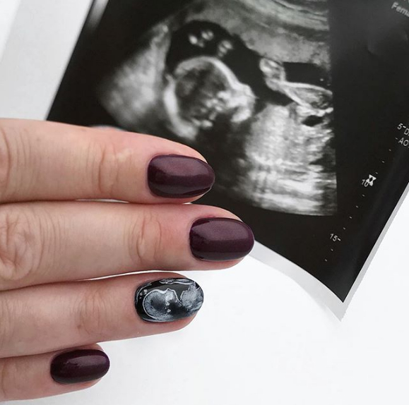 Trào lưu vẽ móng tay hình bào thai: Chia sẻ hạnh phúc làm mẹ và được ngắm con mỗi ngày 0