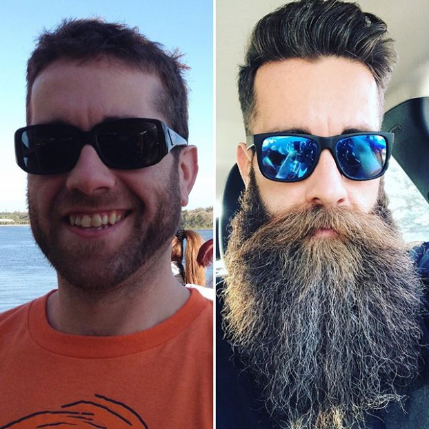 20 bức ảnh ấn tượng chứng minh để râu khiến đàn ông quyến rũ khó cưỡng 5