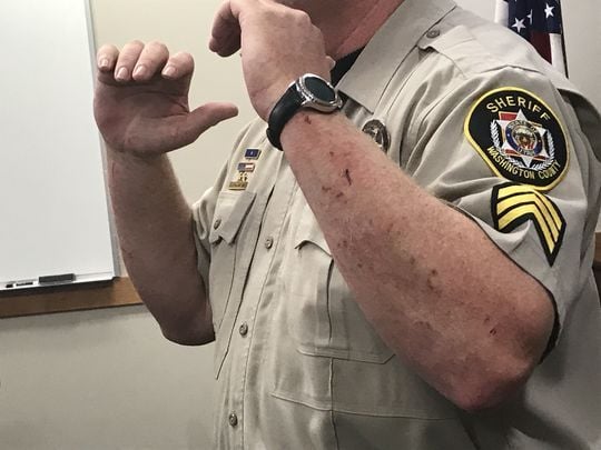Những vết thương trên tay của cảnh sát Thompson - Nguồn: NBC News
