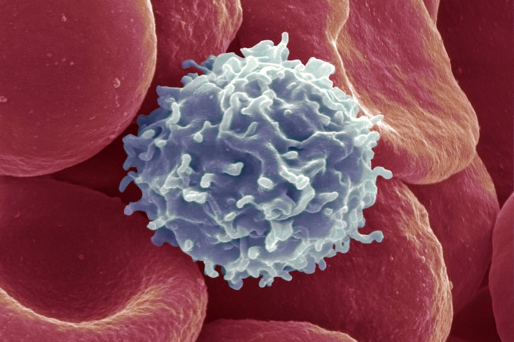 Hình ảnh chụp điện từ của tế bào miễn dịch, xung quanh là các tế bào hồng cầu - Nguồn: New York Times