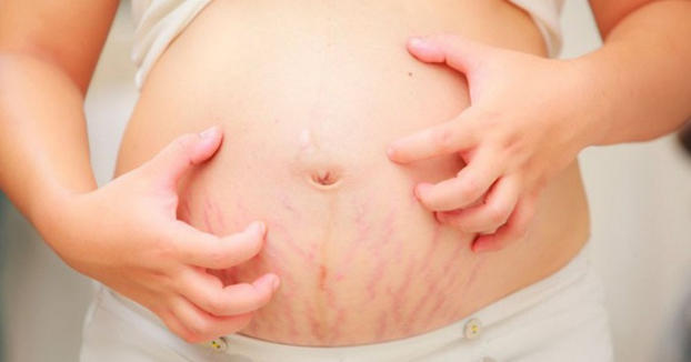   Ngứa da là hiện tượng phổ biến thường gặp ở phụ nữ mang thai.  