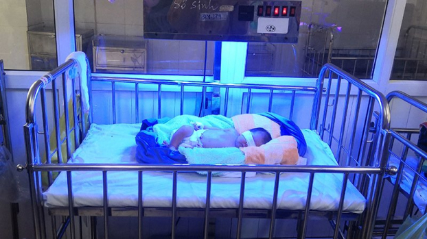   Bé gái đang được chiếu đèn tại bệnh viện Sản Nhi Nghệ An.  