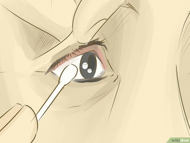 Kỹ năng sơ cứu: Cách loại bỏ dị vật khỏi mắt chính xác và an toàn nhất 5