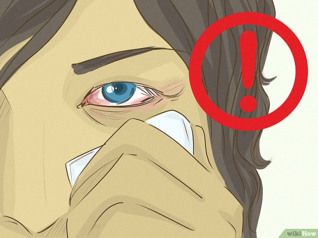 Kỹ năng sơ cứu: Cách loại bỏ dị vật khỏi mắt chính xác và an toàn nhất 8