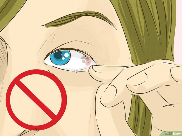 Kỹ năng sơ cứu: Cách loại bỏ dị vật khỏi mắt chính xác và an toàn nhất 10