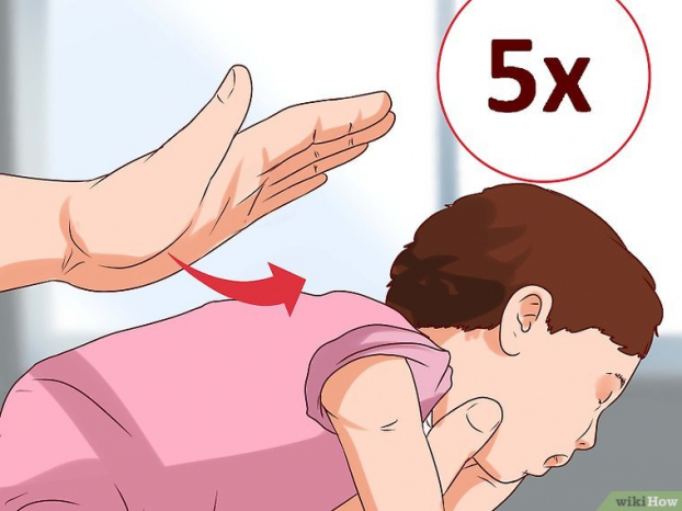 Kỹ năng sơ cứu: Cách xử lý khi trẻ sơ sinh khi bị hóc 4