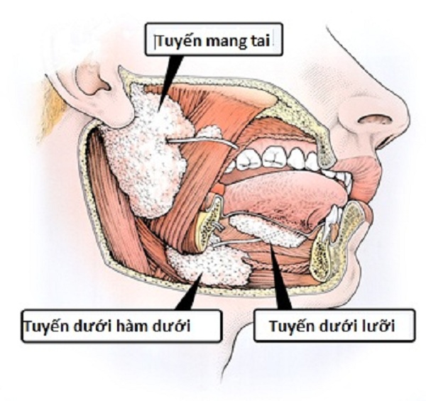 ung thu tuyen nuoc bot 1 Giadinhvietnam