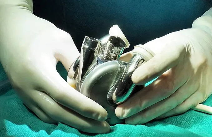 Đại học Úc phát triển thiết bị cấy ghép tim đột phá, mở hi vọng cho bệnh nhân suy tim