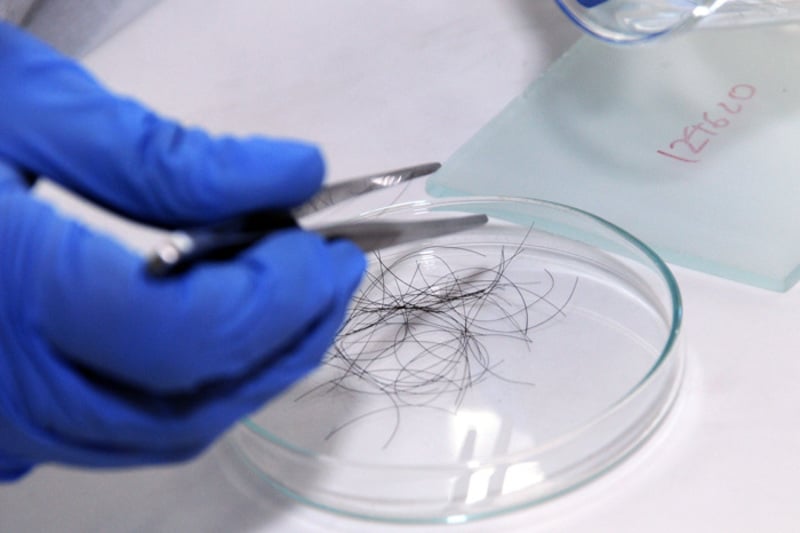 Mang tóc 4 người yêu cũ đi xét nghiệm ADN… để tìm bố cho con