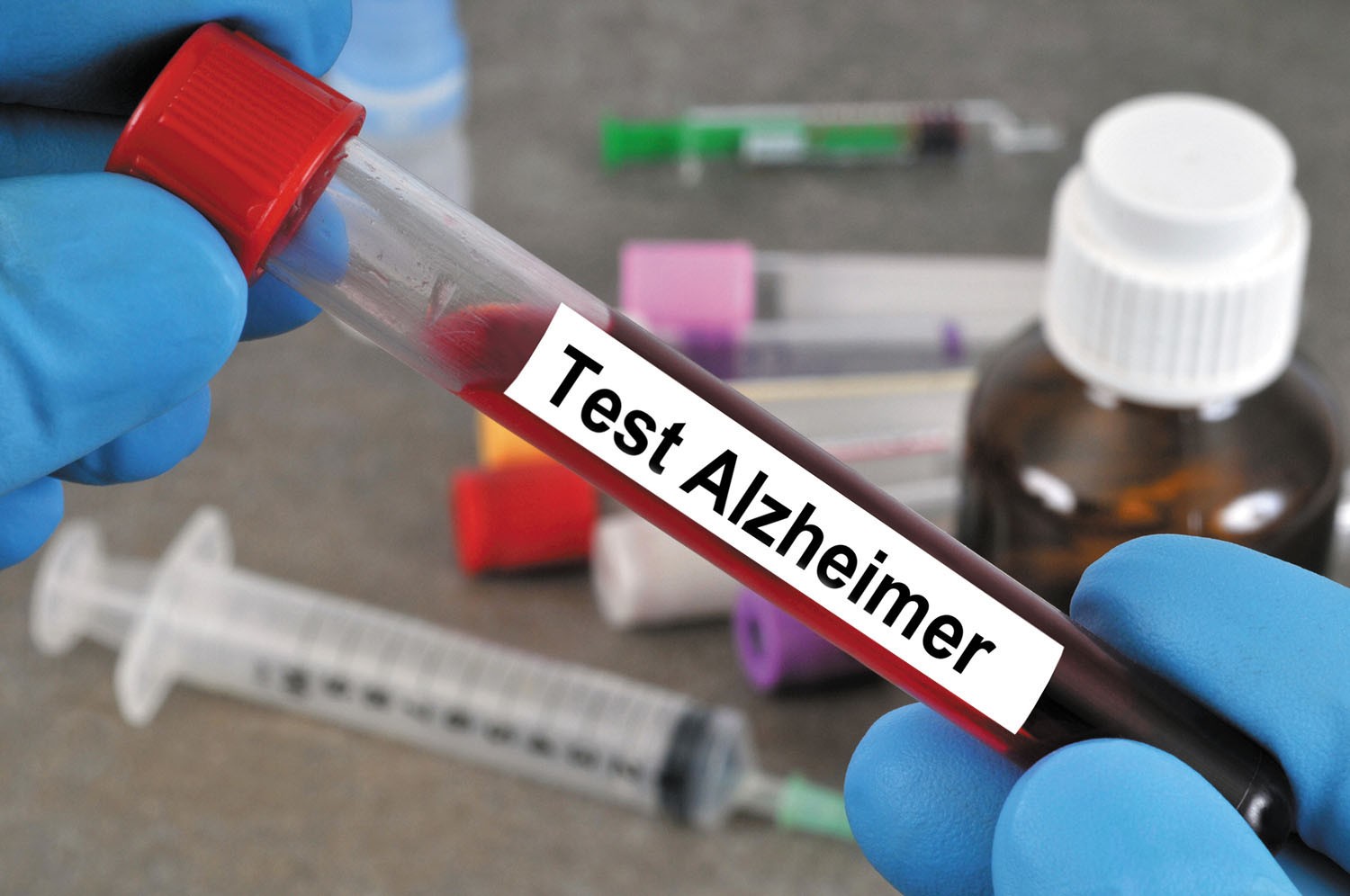 Phát hiện bệnh Alzheimer chính xác 90% nhờ cách làm đơn giản