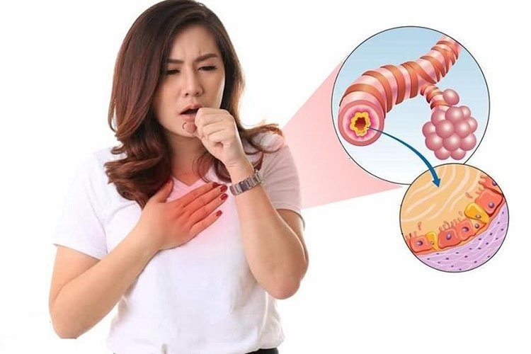 Bí quyết cải thiện viêm phế quản mạn tính từ thảo dược