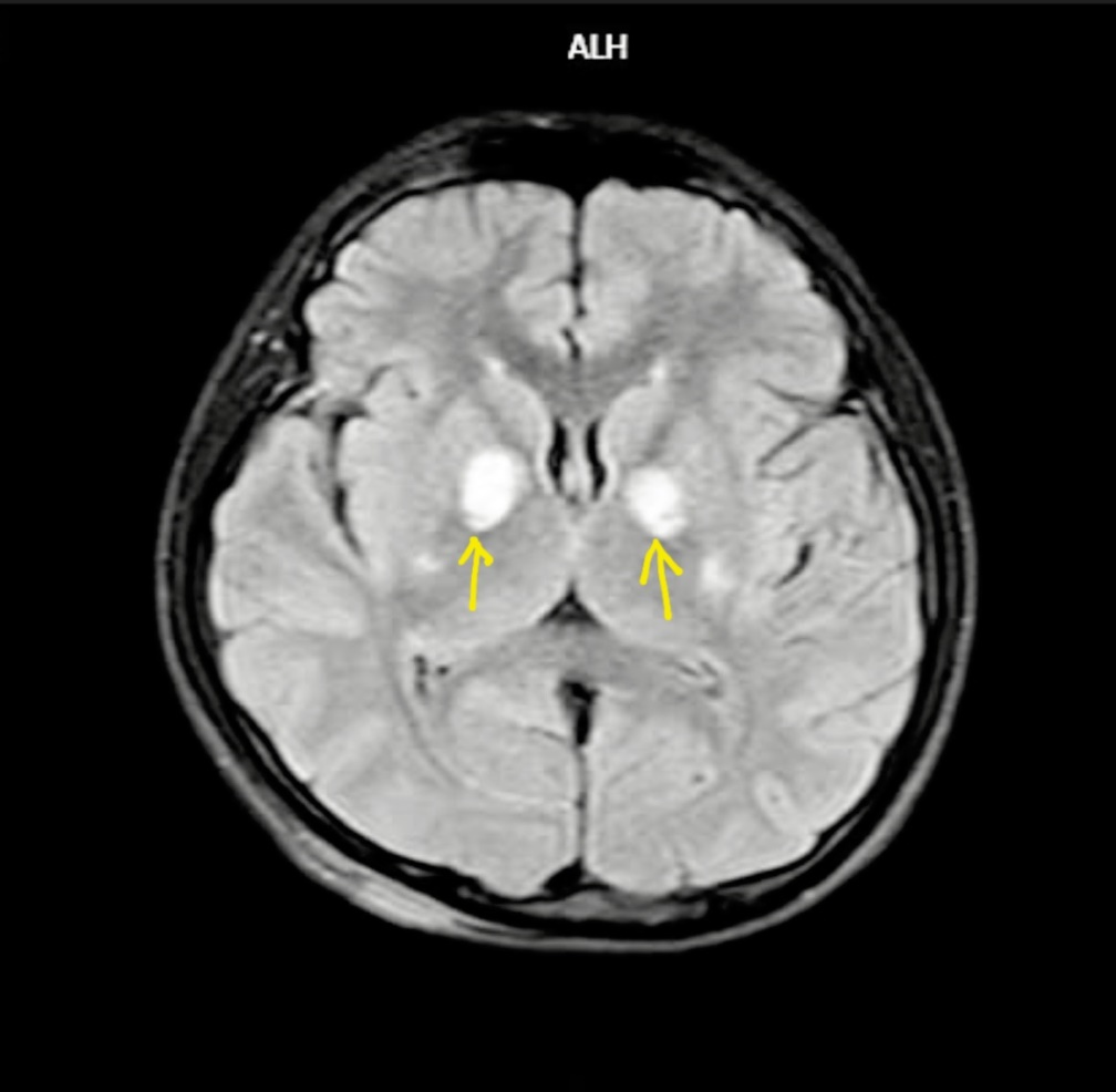 3 người trong 1 nhà ngộ độc khí CO do thói quen thường thấy ở các gia đình