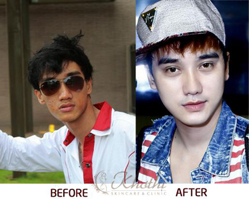 hot-boy-lang-bao-tiet-lo-bi-quyet-dep-nhu-trai-han-giadinhonline.vn 1