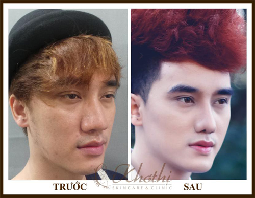 hot-boy-lang-bao-tiet-lo-bi-quyet-dep-nhu-trai-han-giadinhonline.vn 6