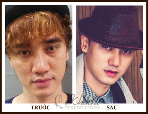 hot-boy-lang-bao-tiet-lo-bi-quyet-dep-nhu-trai-han-giadinhonline.vn 7