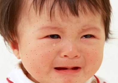benh-soi-va-trieu-chung-qua-4-giai-doan-giadinhonline.vn 2