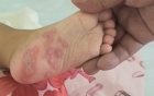 ca-the-gioi-can-chu-dong-phong-chong-dich-benh-ebola--giadinhonline.vn 3