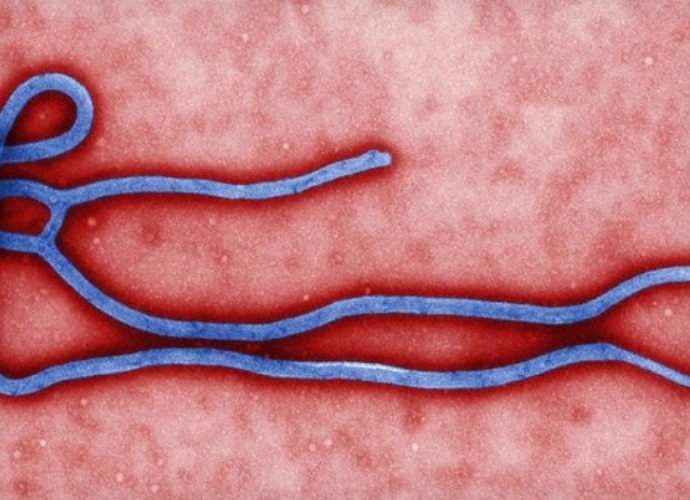 vi-rut-ebola-nguy-hiem-nhu-the-nao--giadinhonline.vn 1